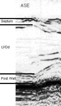 image courtesy of Cardiovascular Ultrasound